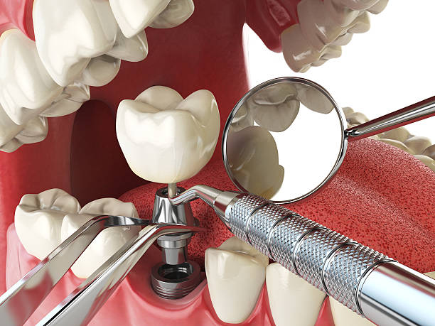 Best Emergency Treatment for Oral Infections in Haven, KS